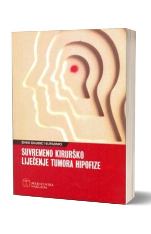SUVREMENO KIRURŠKO LIJEČENJE TUMORA HIPOFIZE