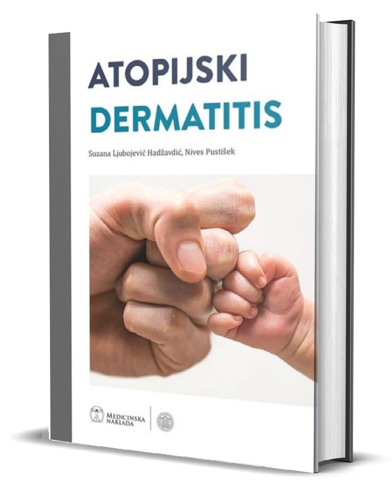 ATOPIJSKI DERMATITIS