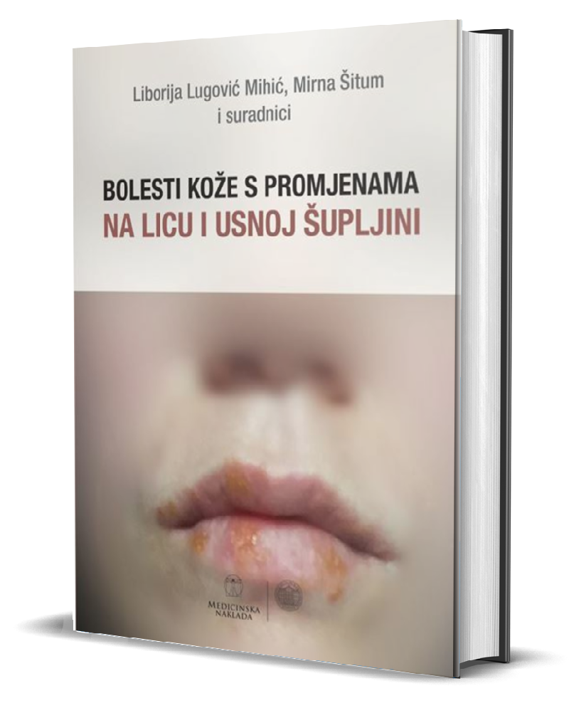BOLESTI KOŽE S PROMJENAMA NA LICU I USNOJ ŠUPLJINI