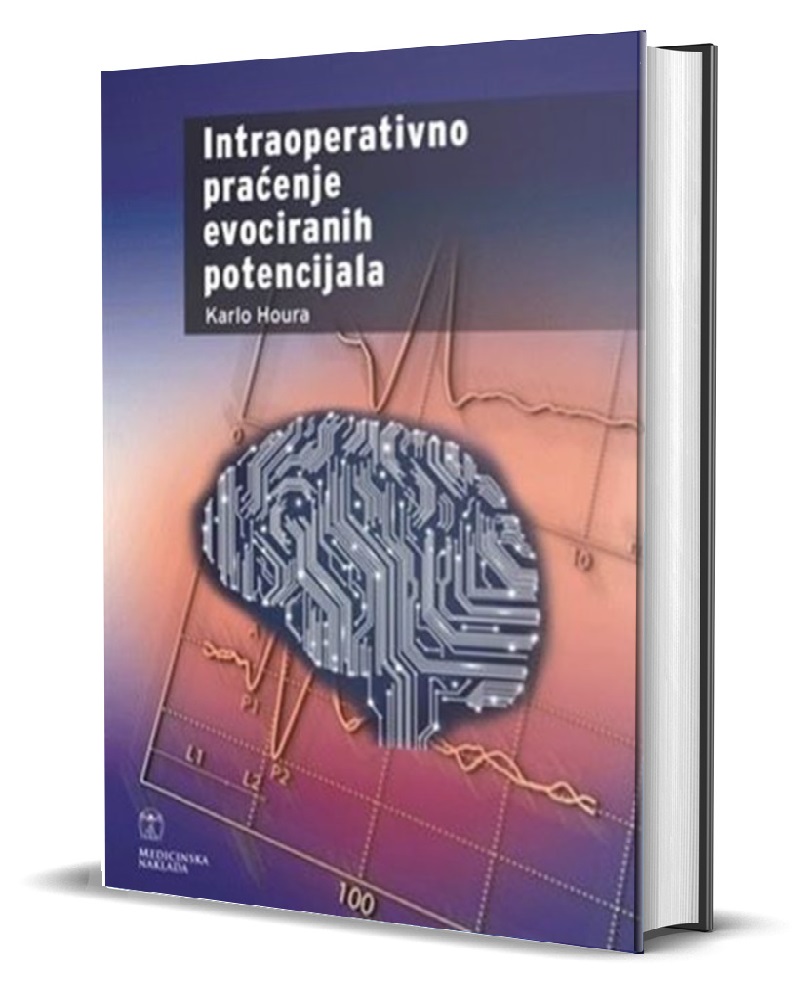 INTRAOPERATIVNO PRAĆENJE EVOCIRANIH POTENCIJALA