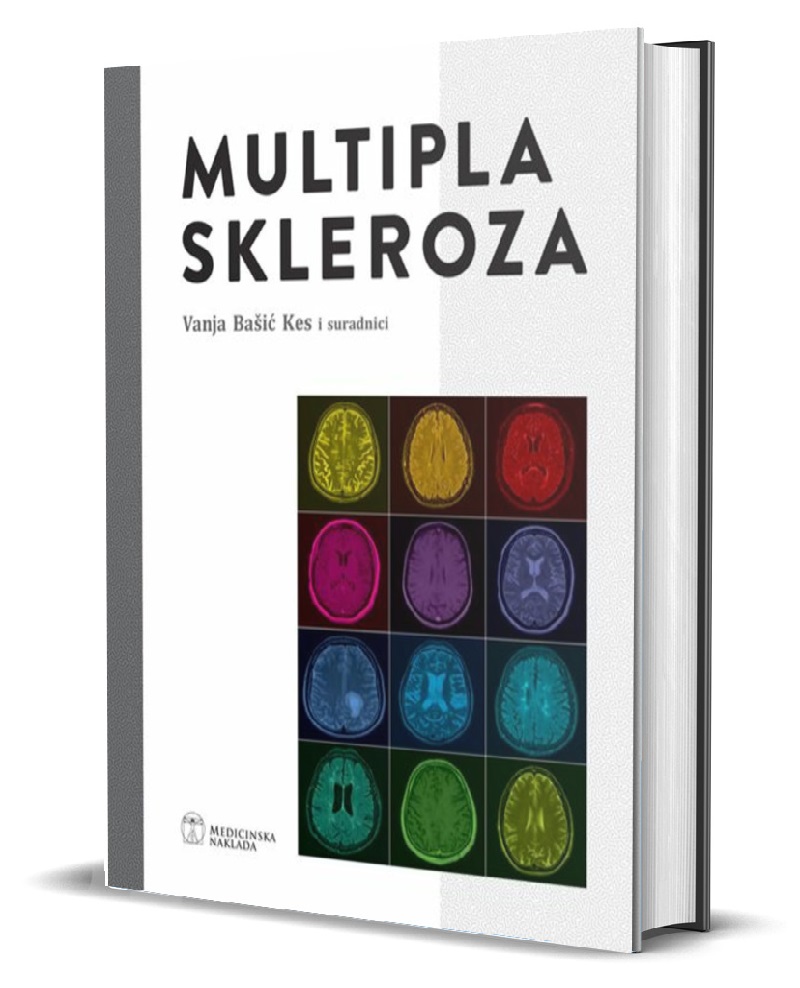 MULTIPLA SKLEROZA