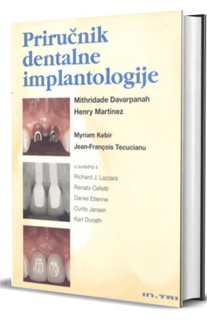 PRIRUČNIK DENTALNE IMPLANTOLOGIJE