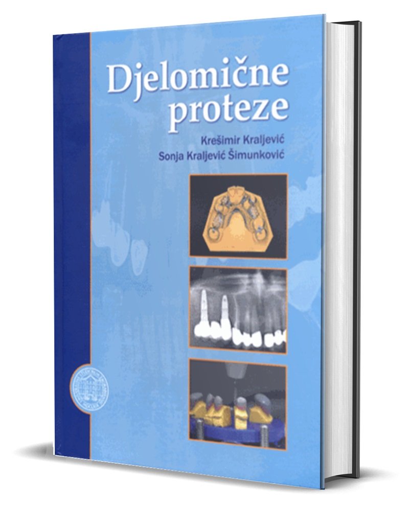 DJELOMIČNE PROTEZE