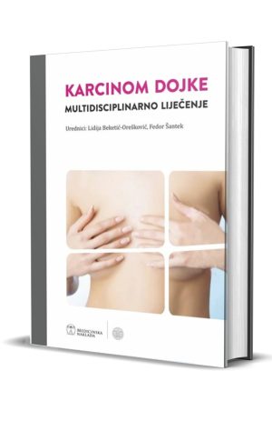 KARCINOM DOJKE