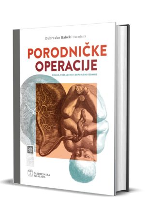 PORODNIČKE OPERACIJE drugo izdanje